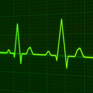 prady selektywne rzeszow